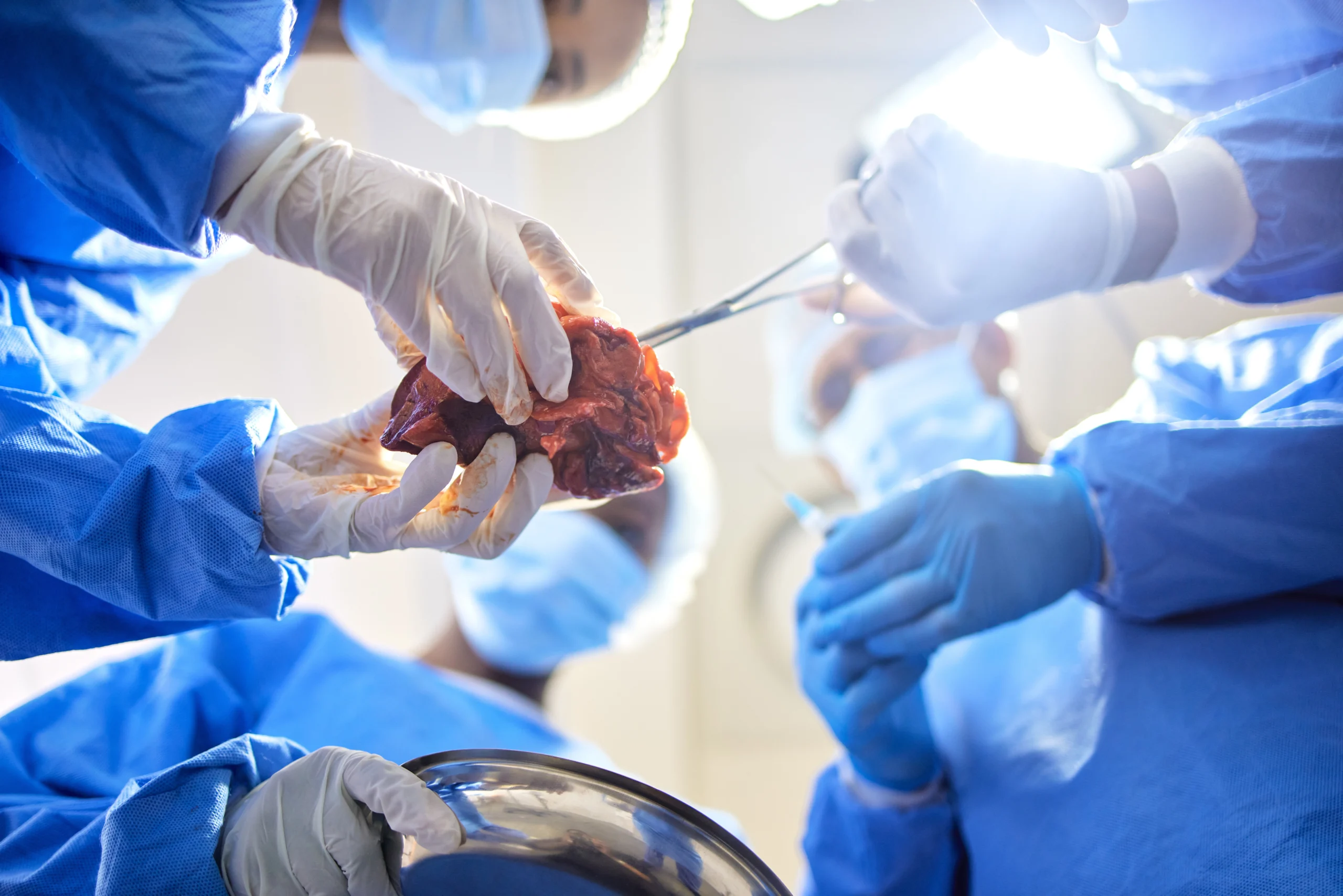 doctors transplanting a human organ in the operating room